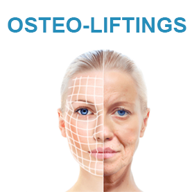 Osteo-liftings